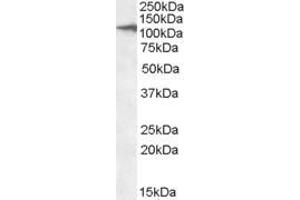 Western Blotting (WB) image for anti-C-Type Lectin Domain Family 16, Member A (CLEC16A) (AA 1040-53) antibody (ABIN570963)