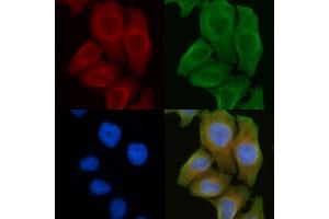 ABIN6261670 and ABIN6272297 staining Hela cells by IF/ICC. (RIMKLB antibody  (Internal Region))