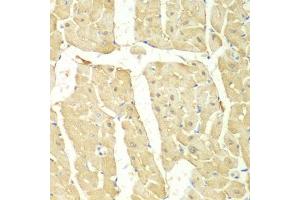 Immunohistochemistry of paraffin-embedded mouse heart using PSMC2 antibody (ABIN5971033) at dilution of 1/100 (40x lens). (PSMC2 antibody)