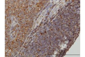 Immunoperoxidase of monoclonal antibody to WDR77 on formalin-fixed paraffin-embedded human tonsil. (WDR77 antibody  (AA 1-342))