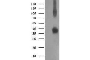 Western Blotting (WB) image for anti-Nonhomologous End-Joining Factor 1 (NHEJ1) antibody (ABIN1499733) (NHEJ1 antibody)