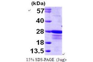SDS-PAGE (SDS) image for Core-Binding Factor, beta Subunit (CBFB) (AA 1-182) protein (His tag) (ABIN7279124) (CBFB Protein (AA 1-182) (His tag))