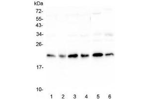 Western blot testing of human 1) HeLa, 2) placenta, 3) HepG2, 4) MCF7, 5) mouse testis and 6) mouse brain lysate with RKIP antibody at 0. (PEBP1 antibody)