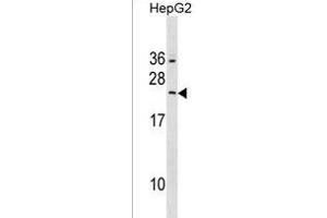 RAB5B Antibody (Center) (ABIN1538703 and ABIN2850042) western blot analysis in HepG2 cell line lysates (35 μg/lane). (RAB5B antibody  (AA 85-112))