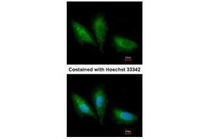 ICC/IF Image Immunofluorescence analysis of paraformaldehyde-fixed A549, using PRKCSH, antibody at 1:200 dilution. (PRKCSH antibody)