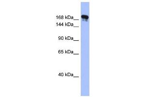 WB Suggested Anti-SYNJ1 Antibody Titration:  0. (Synaptojanin 1 antibody  (Middle Region))