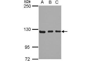 WB Image Sample (30 ug of whole cell lysate) A: 293T B: A431 C: HeLa 5% SDS PAGE antibody diluted at 1:1000 (ITGA9 antibody  (N-Term))
