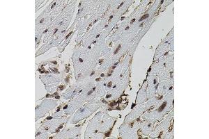 Immunohistochemistry of paraffin-embedded mouse heart using EIF4G2 antibody (ABIN5971499) (40x lens). (EIF4G2 antibody)