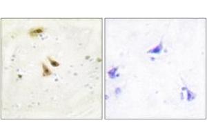 Immunohistochemistry analysis of paraffin-embedded human brain tissue, using UBF1 Antibody. (UBTF antibody  (AA 501-550))