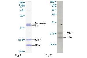 ZAK Protein (AA 1-455) (GST tag)