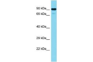 Host: Rabbit Target Name: CEP89 Sample Type: Jurkat Whole Cell lysates Antibody Dilution: 1. (CEP89 antibody  (N-Term))