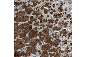 Immunohistochemical staining of human stomach with SLC2A13 polyclonal antibody  shows strong cytoplasmic positivity in glandular cells at 1:20-1:50 dilution. (SLC2A13 antibody)