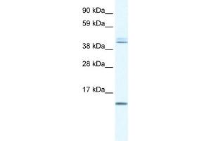 WB Suggested Anti-TSFM Antibody Titration:  0.