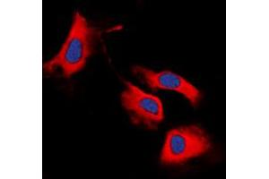Immunofluorescent analysis of RET staining in MCF7 cells. (Ret Proto-Oncogene antibody  (C-Term))