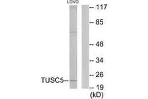 Western blot analysis of extracts from LOVO cells, using TUSC5 Antibody.