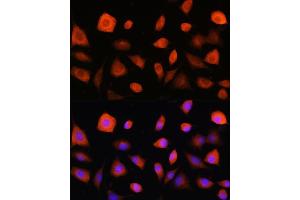 Immunofluorescence analysis of L929 cells using eIF2B epsilon (eIF2B epsilon (EIF2B5)) Rabbit pAb (ABIN6130359, ABIN6140041, ABIN6140042 and ABIN6214448) at dilution of 1:100. (EIF2B5 antibody  (AA 442-721))