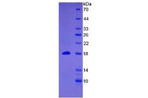 SDS-PAGE analysis of Human BMP15 Protein. (BMP15 Protein)