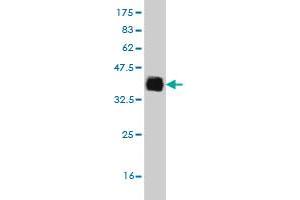 Western Blot detection against Immunogen (34. (ELAC1 antibody  (AA 282-362))