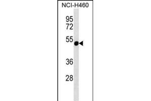 RTDR1 Antibody (N-term) (ABIN657164 and ABIN2846298) western blot analysis in NCI- cell line lysates (35 μg/lane). (RTDR1 antibody  (N-Term))