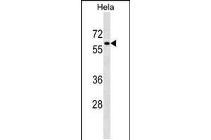 Western blot analysis in Hela cell line lysates (35ug/lane). (PAF1/PD2 antibody  (C-Term))