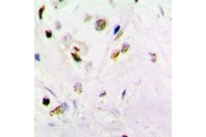 Immunohistochemical analysis of PSMB10 staining in mouse brain formalin fixed paraffin embedded tissue section. (PSMB10 antibody)