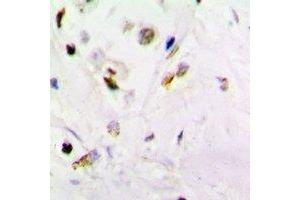 Immunohistochemical analysis of PSMB10 staining in mouse brain formalin fixed paraffin embedded tissue section.