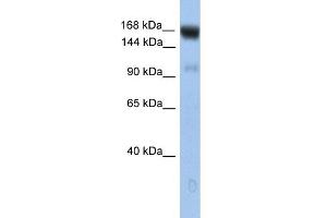 WB Suggested Anti-UBE4B Antibody Titration: 0. (UBE4B antibody  (N-Term))