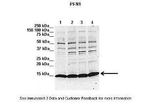 Lanes:   1. (PFN1 antibody  (N-Term))