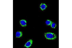 Confocal immunofluorescent analysis of B-RAF Antibody  f with Hela cell followed by Alexa Fluor 488-conjugated goat anti-rabbit lgG (green).