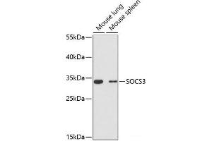 Western blot analysis of extracts of various cell lines using SOCS3 Polyclonal Antibody at dilution of 1:3000. (SOCS3 antibody)