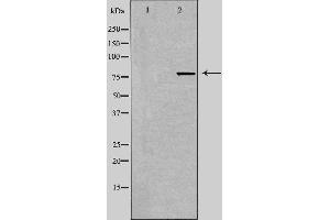 Western blot analysis of extracts from 293 cells using TACC3 antibody. (TACC3 antibody  (C-Term))