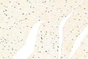 Immunohistochemistry analysis of paraffin-embedded mouse heart using CSL (ABIN7073486) at dilution of 1: 500 (CSHL1 antibody)