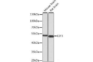 Western blot analysis of extracts of various cell lines using E2F3 Polyclonal Antibody at dilution of 1:1000. (E2F3 antibody)