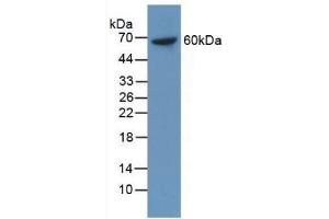 Detection of Recombinant MACC1, Human using Monoclonal Antibody to Metastasis Associated In Colon Cancer 1 (MACC1) (MACC1 antibody  (AA 522-784))