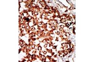Image no. 1 for anti-Nuclear Receptor Binding Protein 1 (NRBP1) (N-Term) antibody (ABIN360550) (NRBP1 antibody  (N-Term))