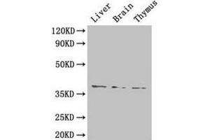 Western Blot Positive WB detected in: Mouse liver tissue, Mouse brain tissue, Mouse thymus tissue All lanes: HAVCR1 antibody at 4 μg/mL Secondary Goat polyclonal to rabbit IgG at 1/50000 dilution Predicted band size: 39 kDa Observed band size: 39 kDa (HAVCR1 antibody  (AA 21-290))