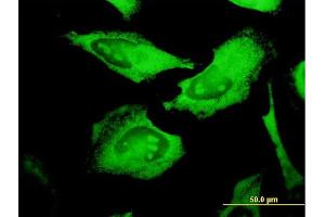 Immunofluorescence of monoclonal antibody to PROCR on HeLa cell. (PROCR antibody  (AA 1-238))