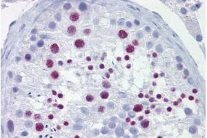 Immunohistochemistry with Testis tissue at an antibody concentration of 10µg/ml using anti-BRD3 antibody (ARP34431_P050) (BRD3 antibody  (Middle Region))