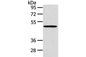 Western blot analysis of 231 cell using HTRA1 Polyclonal Antibody at dilution of 1:500 (HTRA1 antibody)
