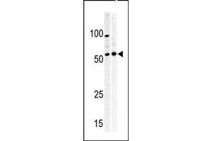 Western blot analysis of anti-PKMYT1 Pabin (left) and Y79 (right)cell line lysate. (PKMYT1 antibody  (C-Term))