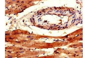 Immunohistochemistry of paraffin-embedded human heart tissue using ABIN7172377 at dilution of 1:100 (TRAPPC9 antibody  (AA 780-1030))