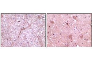 Immunohistochemical analysis of paraffin-embedded human cerebrum tissue (left) and myelencephalon tissue (right), showing cytoplasmic localization using Dynamin2 mouse mAb with DAB staining. (DNM2 antibody)