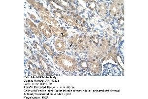Rabbit Anti-GEM Antibody  Paraffin Embedded Tissue: Human Kidney Cellular Data: Epithelial cells of renal tubule Antibody Concentration: 4. (GEM antibody  (C-Term))