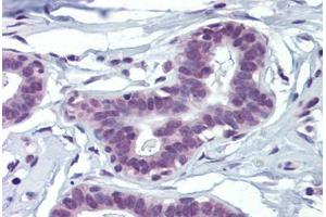 Human Breast (formalin-fixed, paraffin-embedded) stained with MAZ antibody ABIN462205 followed by biotinylated goat anti-rabbit IgG secondary antibody ABIN481713, alkaline phosphatase-streptavidin and chromogen. (MAZ antibody  (N-Term))