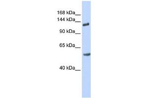 WB Suggested Anti-ROBO2 Antibody Titration: 0. (ROBO2 antibody  (N-Term))
