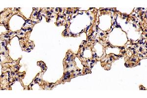Detection of CK7 in Rat Lung Tissue using Polyclonal Antibody to Cytokeratin 7 (CK7)