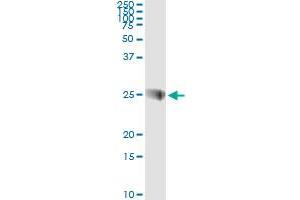 Western Blotting (WB) image for anti-Synaptosomal-Associated Protein, 23kDa (SNAP23) (AA 1-212) antibody (ABIN599065) (SNAP23 antibody  (AA 1-212))