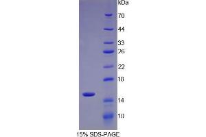 SDS-PAGE analysis of IL34 Protein. (IL-34 Protein)