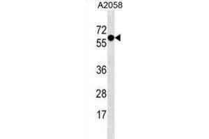 Western Blotting (WB) image for anti-Synaptotagmin IV (SYT4) antibody (ABIN3000889)