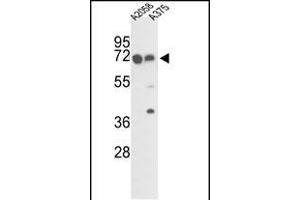 Western blot analysis of FKBP10 Antibody (C-term) (ABIN391573 and ABIN2841510) in  and  cell line lysates (35 μg/lane). (FKBP10 antibody  (C-Term))